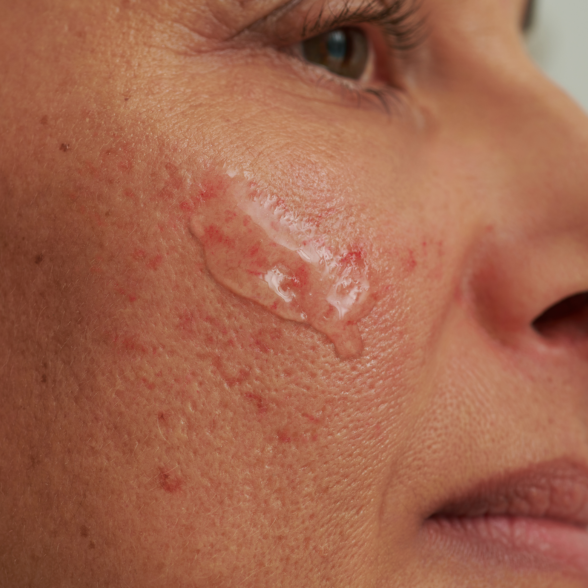 SENSACEA GESICHTSEMULSION Kennenlerngröße