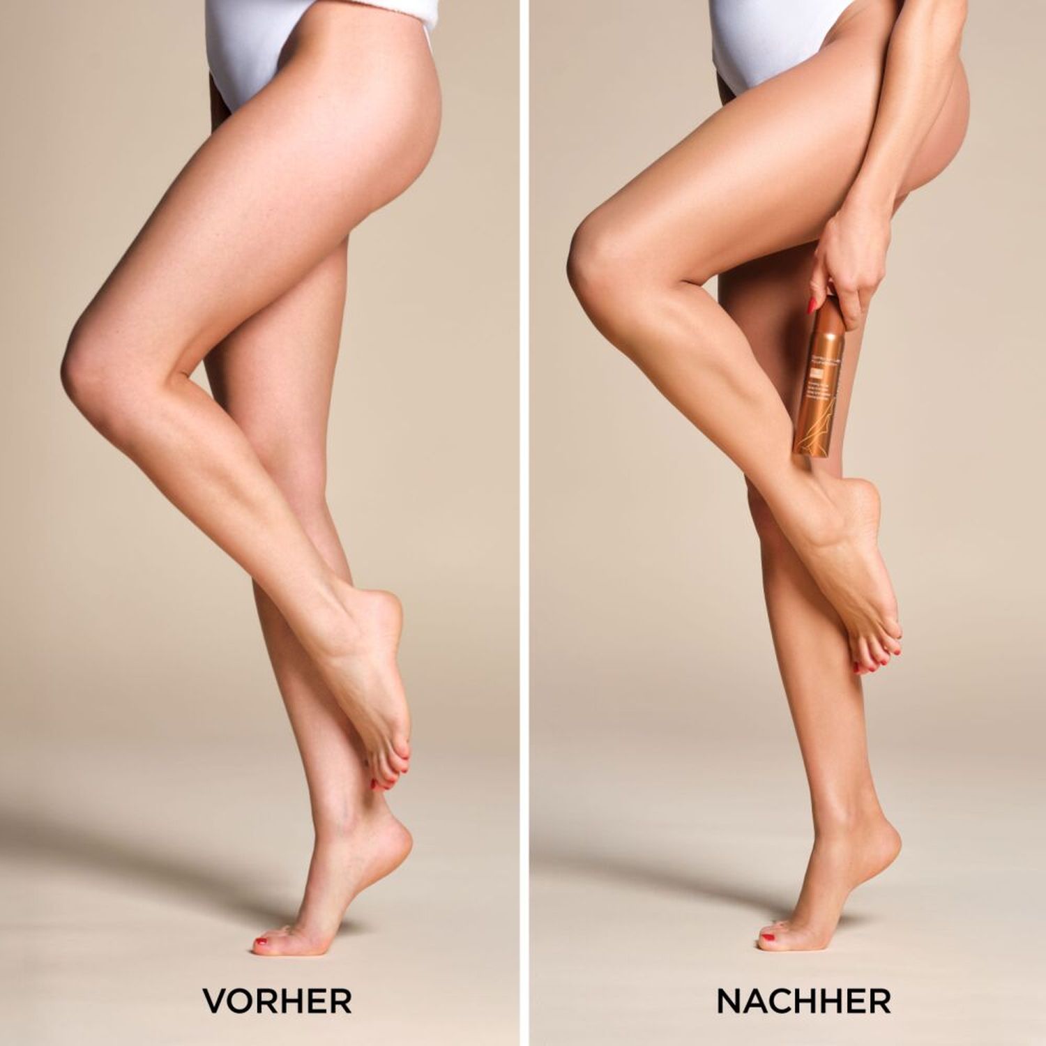 Spray on Leg Foundation