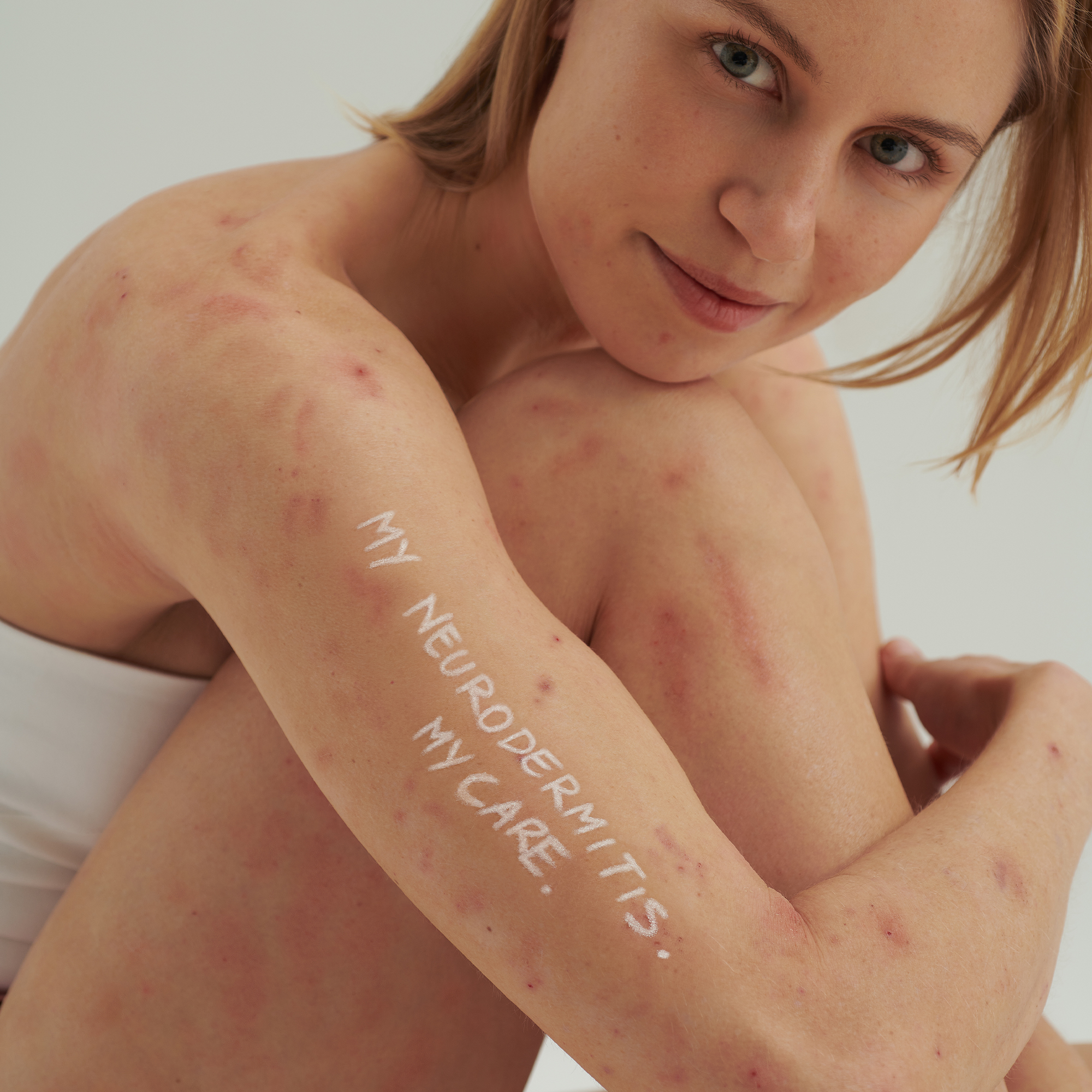 EXTRODERM AUGENCREME