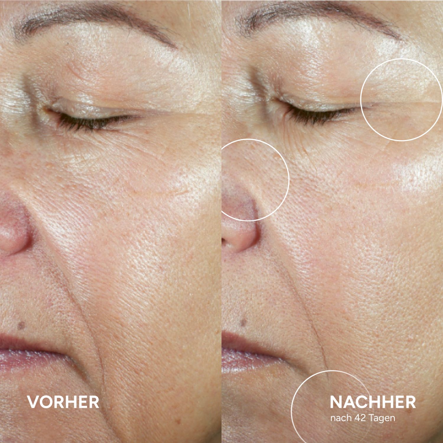 SYSTEM ABSOLUTE Verjüngendes Beauty-Fluid Serum